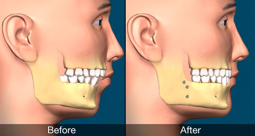 Oral Surgery Jaw 10