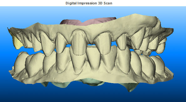 3d-scan