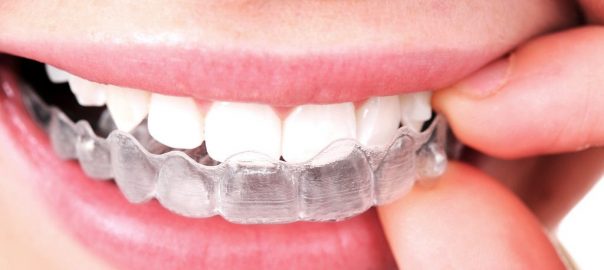 Invisalign Treatment After-Care