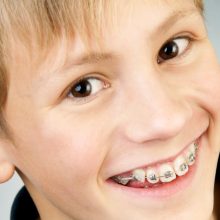 early orthodontic treatment benefits