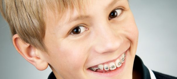 early orthodontic treatment benefits