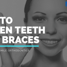 how to whiten teeth with braces