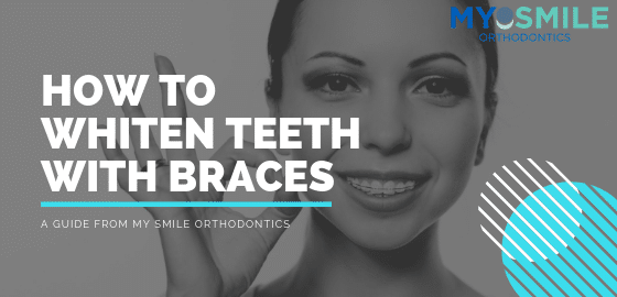 how to whiten teeth with braces