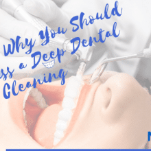 6 Reasons Why You Should Never Miss a Deep Dental Cleaning