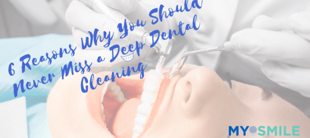 6 Reasons Why You Should Never Miss a Deep Dental Cleaning